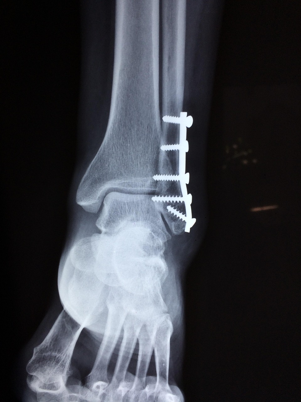 Welchen Einfluss hat die deutsche orthopädische Medizin auf die globale Praxis?