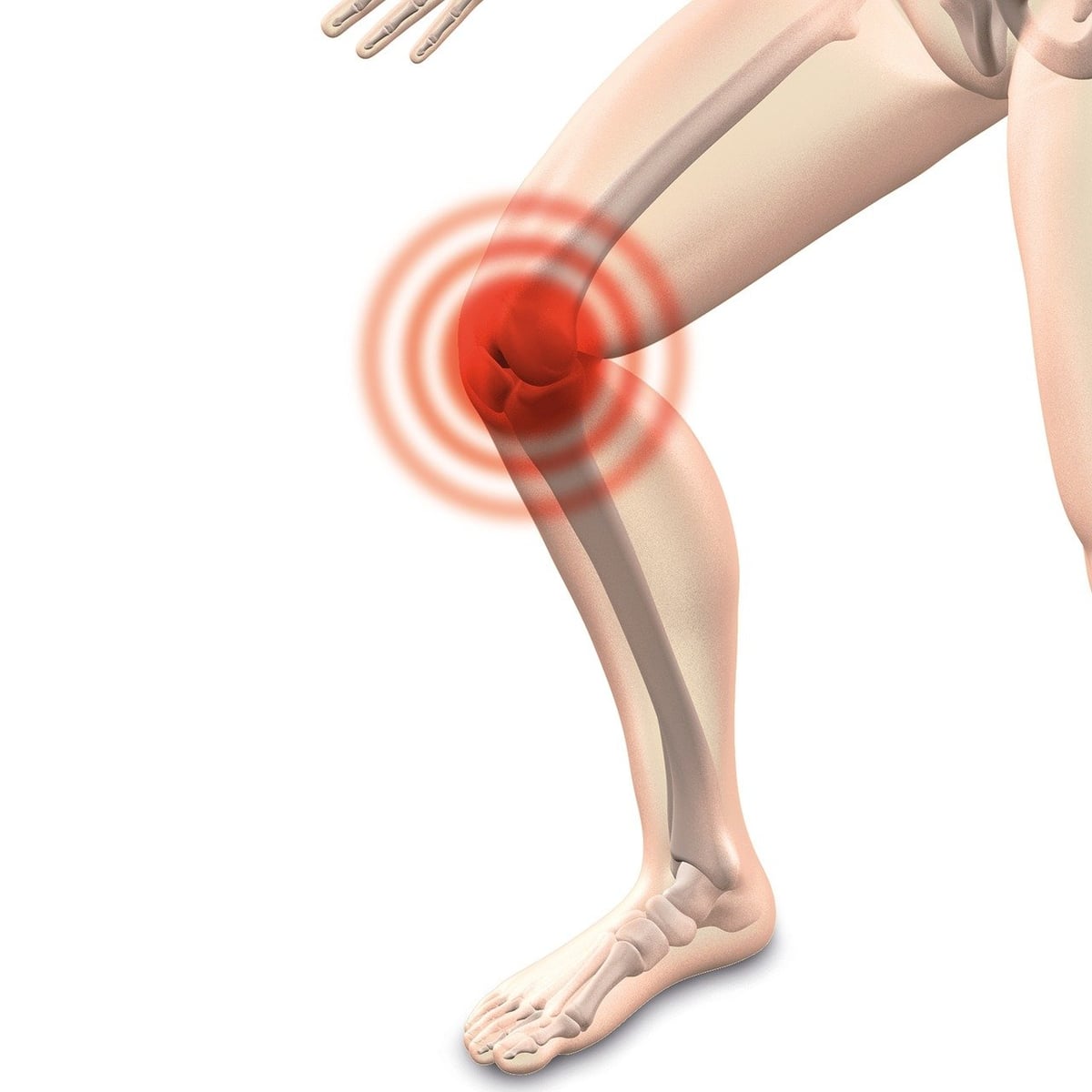 Was zeigen aktuelle Studien zur Behandlung von Arthrose?