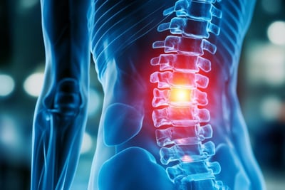 Was sind die Mythen und Realitäten über Arthrose?